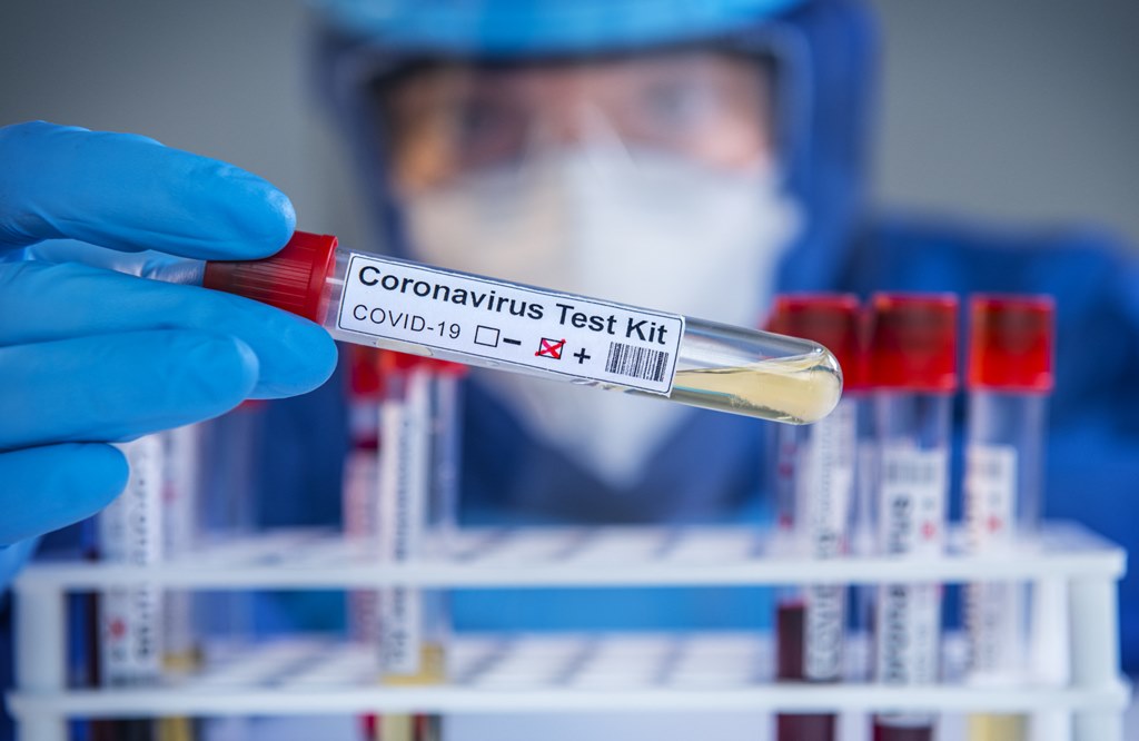 Elkezdték a városban a pedagógusok koronavírus-tesztelését